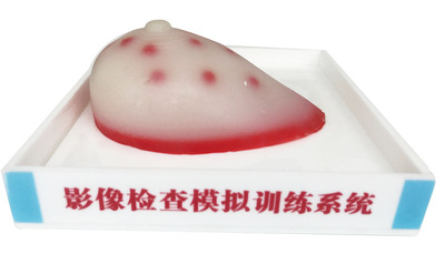 乳腺影像诊断模型